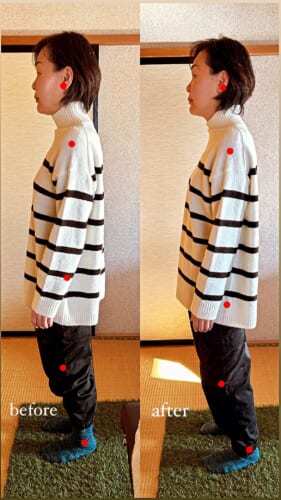 櫻井整骨院 沼津院の施術ビフォーアフター事例 29