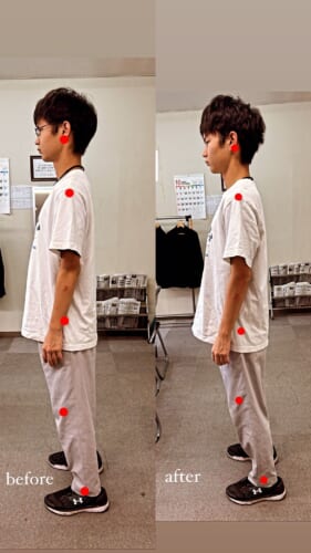 櫻井整骨院 沼津院の施術ビフォーアフター事例 16