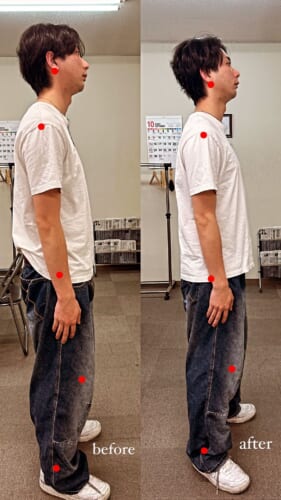 櫻井整骨院 沼津院の施術ビフォーアフター事例 13